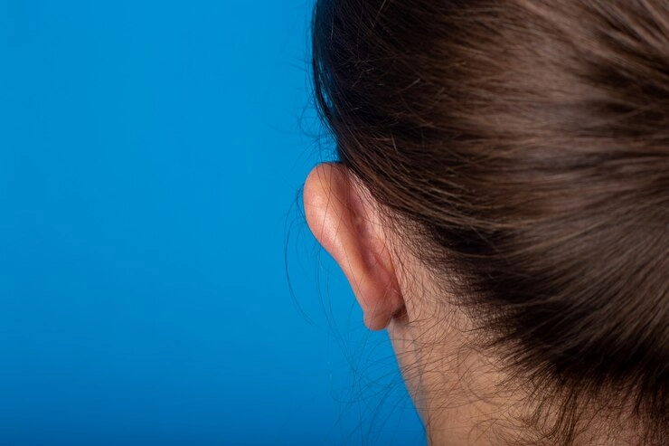 از بین رفتن عصب گوش - تصویر گوش و قسمتی از موی سر از پشت سر 