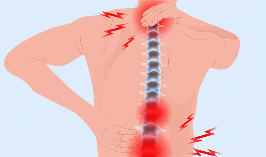 آرتروز و بیرون زدگی دیسک کمر