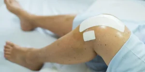 post-surgical-pain01